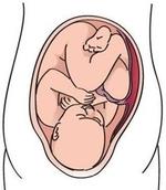 Baby in a normal womb position.