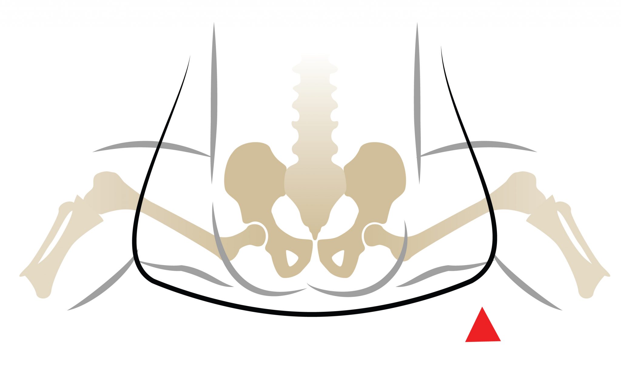 Baby Carriers & Other Equipment International Hip Dysplasia Institute